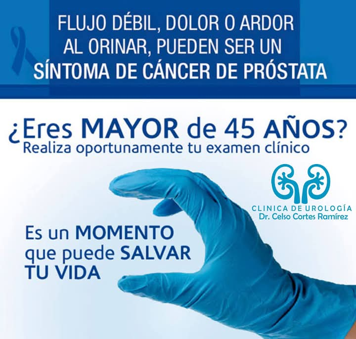 Urología oncológica 